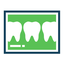 Assessing your oral health - Toronto Bloor West Dental Group - Toronto